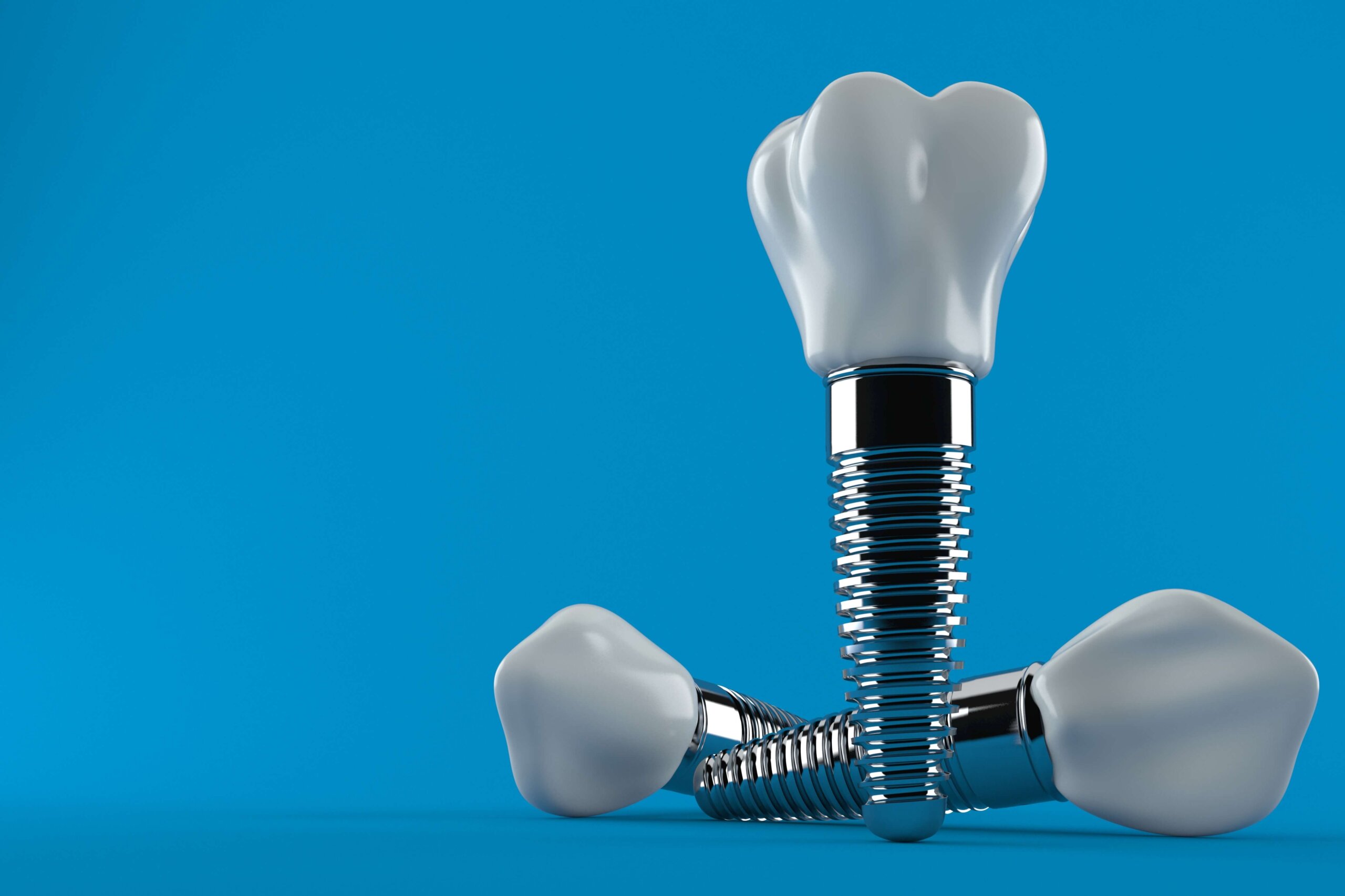 Dental Implants at Aquila Dental