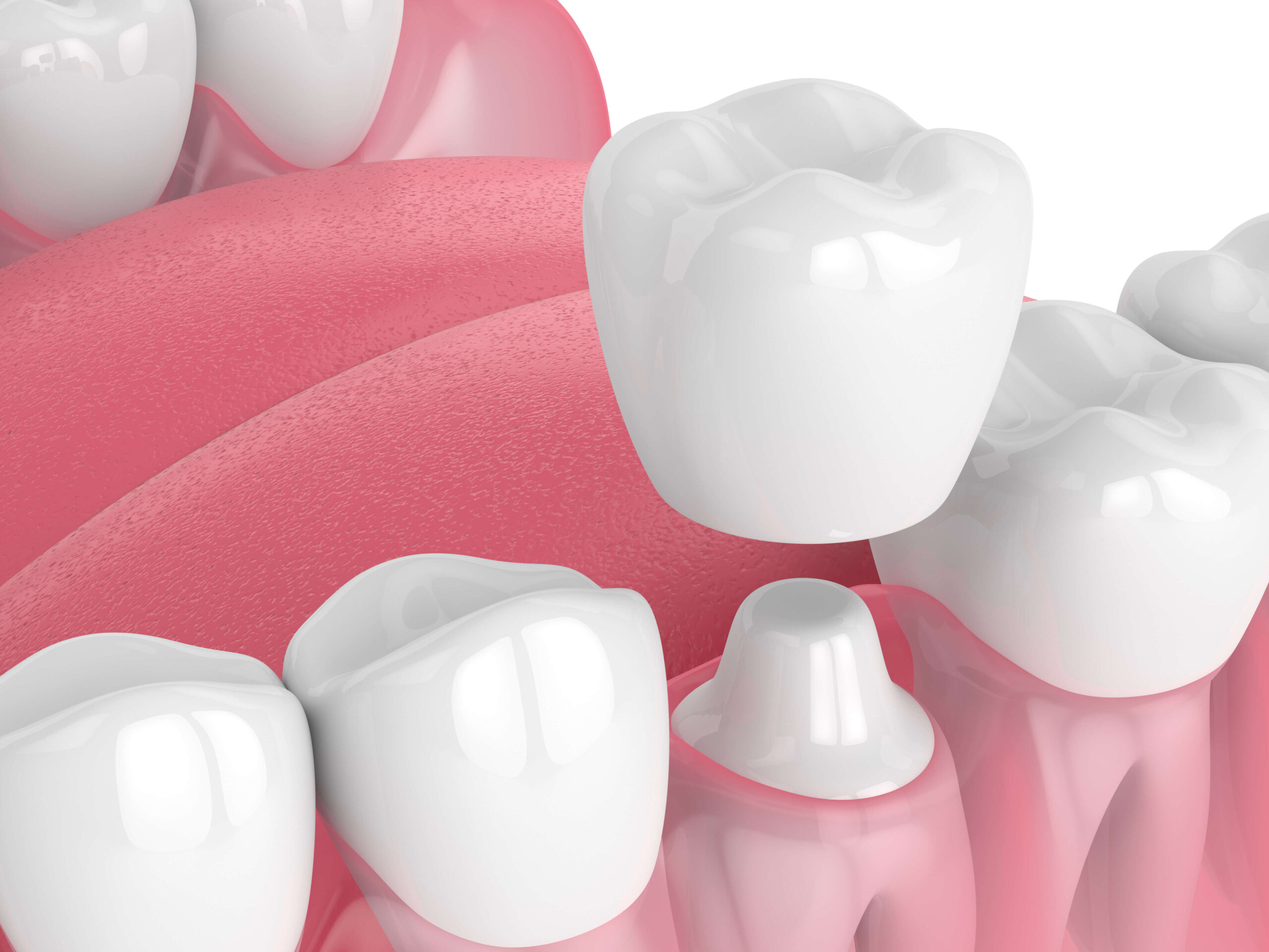 Proven Dental Results at Aquila Dental