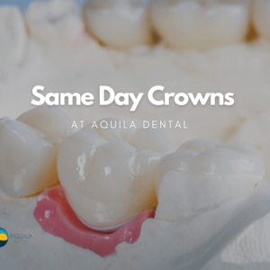 Same Day Crowns at Aquila Dental Chandler AZ