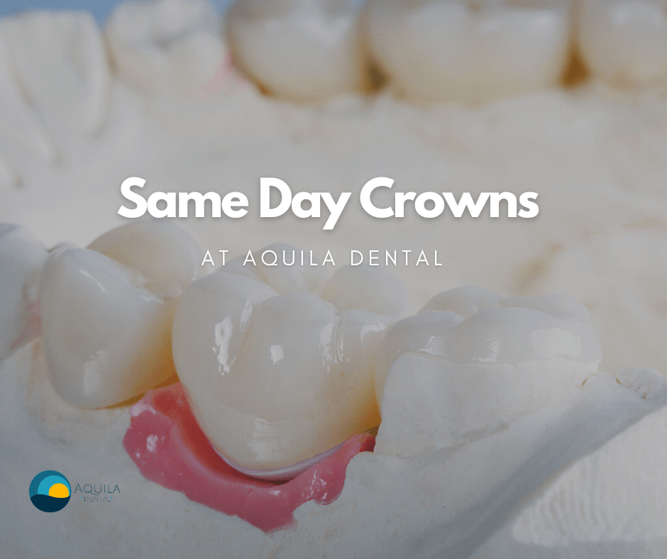 Same Day Crowns at Aquila Dental Chandler AZ