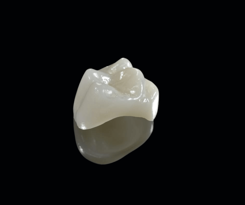 CEREC Crowns are durable in nature and are long lasting