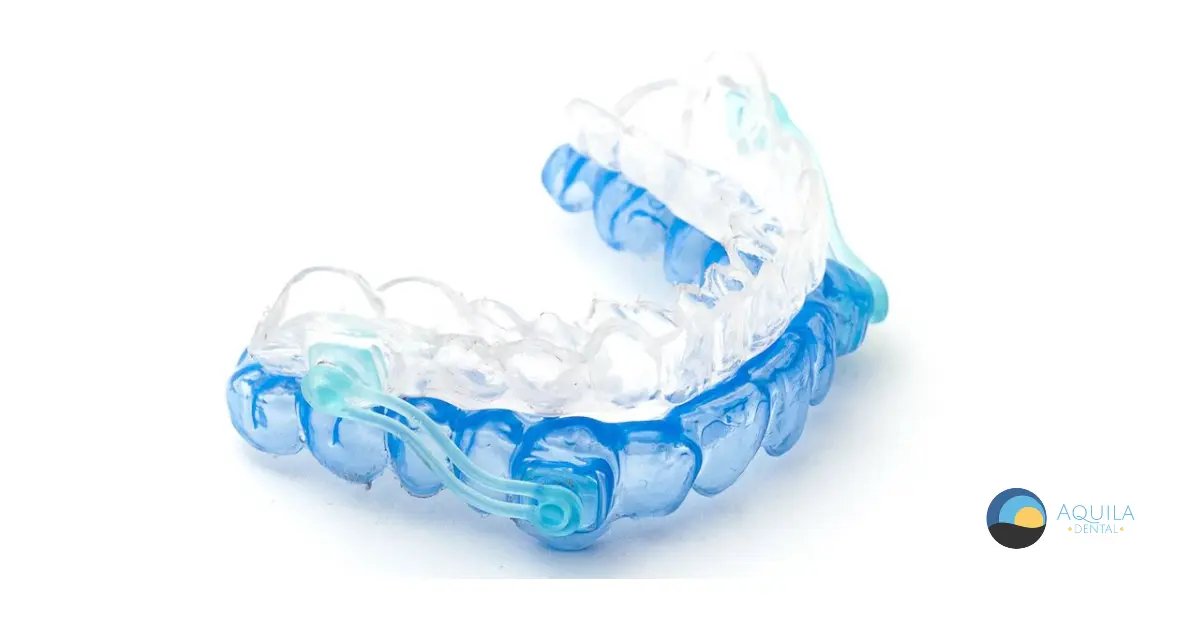Oral mouth piece for sleep apnea and bruxism are available at Aquila Dental in Chandler, AZ and are custom fitted by Dr. Rich Higgs our lead dentist